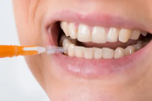 Remove the Food Stuck Between Teeth
