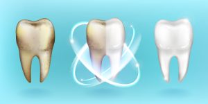 Here Are 6 Reasons Why You Have See-Through or Translucent Teeth