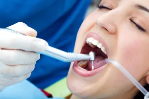 Tooth Extraction