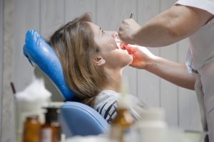 Itchy Gums
