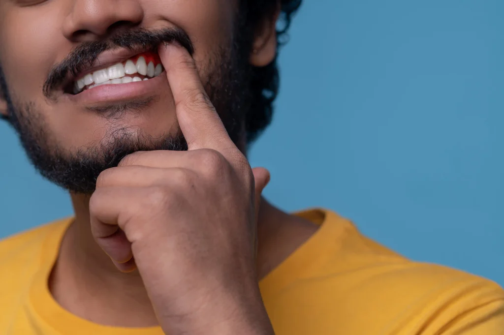 can periodontal disease be cured