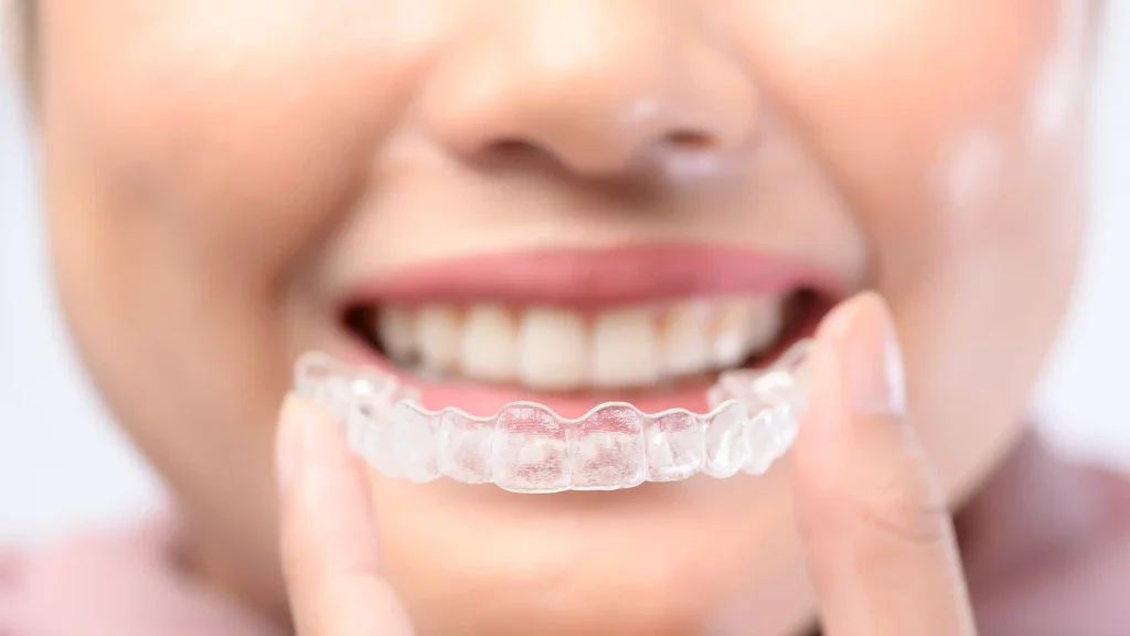 adult invisalign