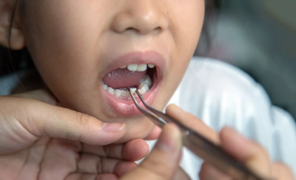 first dental visit cost for toddler