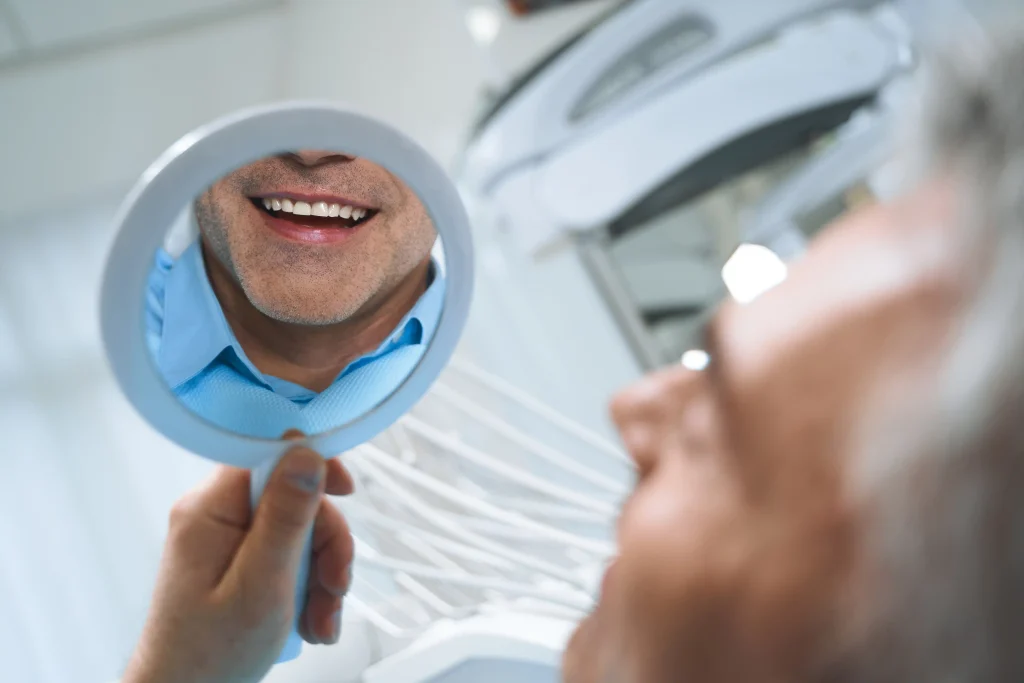 longevity of dental bonding